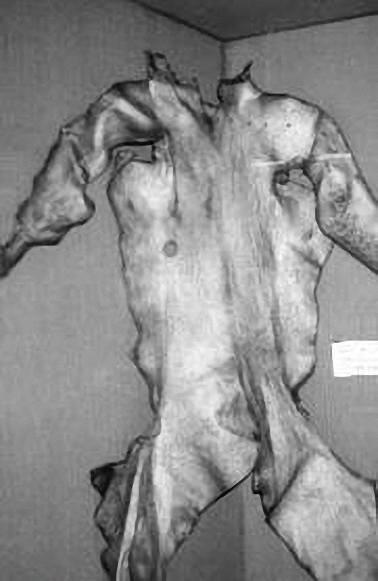 Peau Humaine Peau Humaine